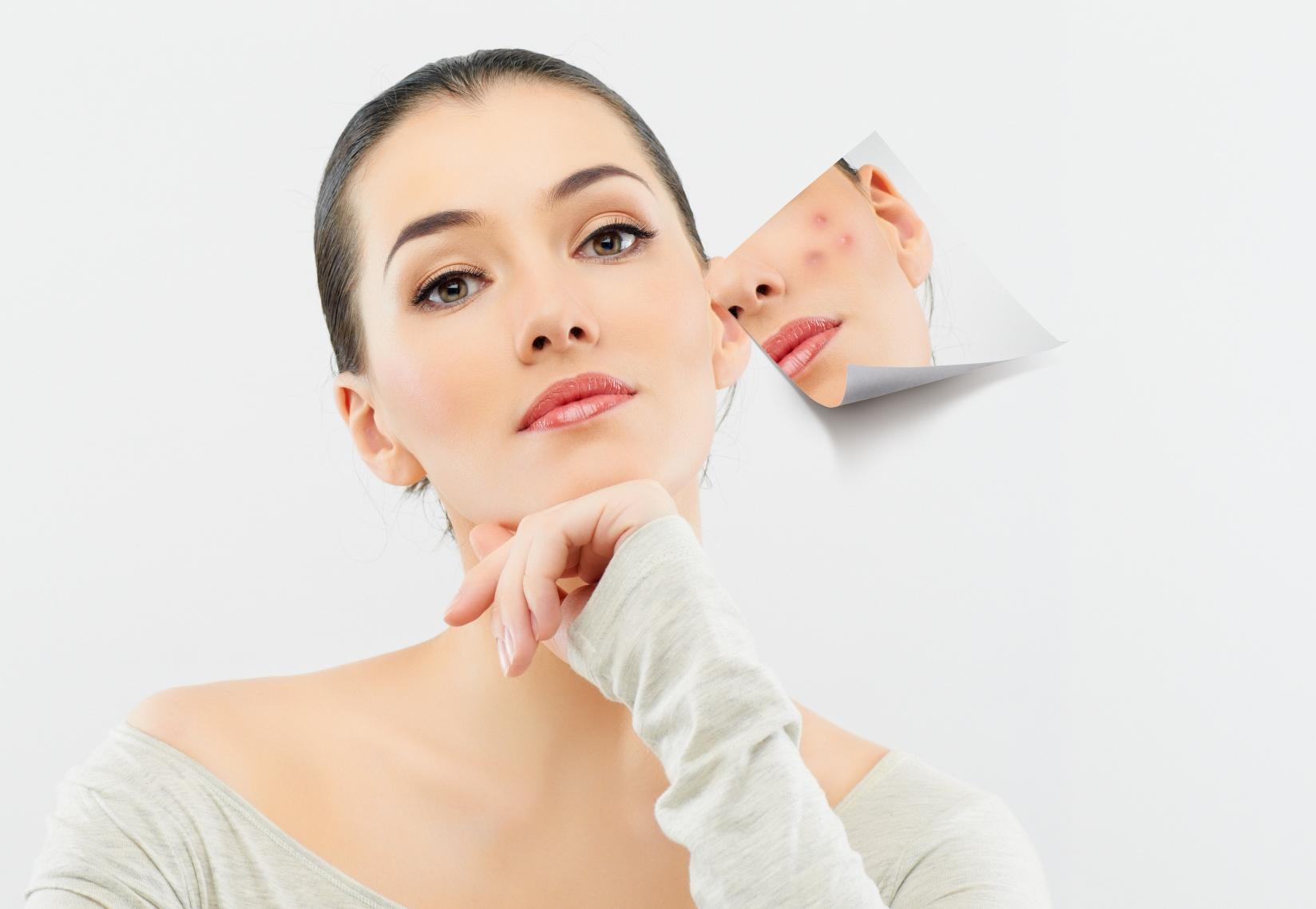 Hút bay mụn, cải thiện nếp nhăn và sắc tố da, đồng thời giúp da thấm hút dưỡng chất tốt hơn là những công dụng nổi trội của máy hút mụn Rio Skin Renew